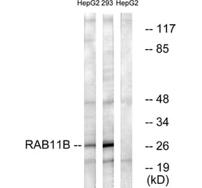 Western Blot - Anti-RAB11B Antibody (C18218) - Antibodies.com