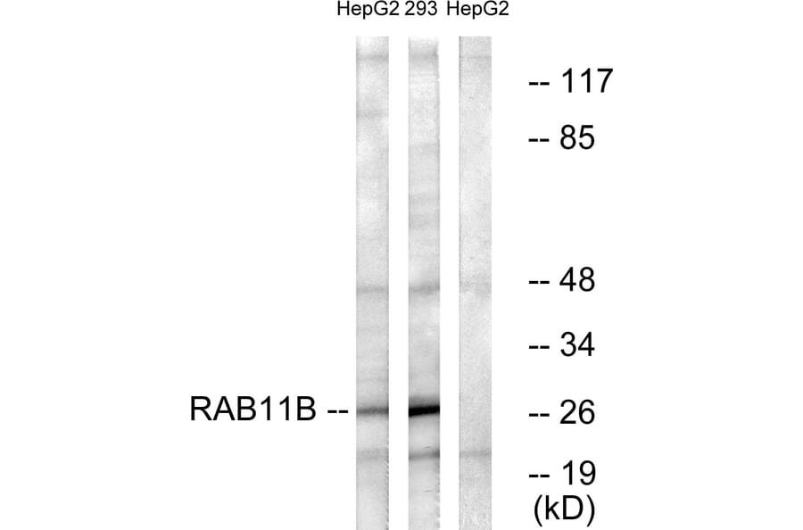 Western Blot - Anti-RAB11B Antibody (C18218) - Antibodies.com