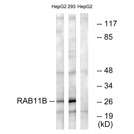 Western Blot - Anti-RAB11B Antibody (C18218) - Antibodies.com