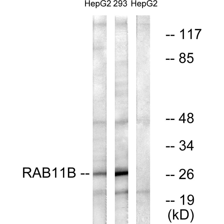 Western Blot - Anti-RAB11B Antibody (C18218) - Antibodies.com