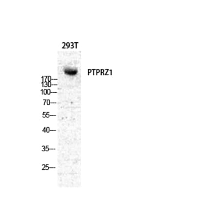 Western Blot - Anti-PTPRZ1 Antibody (C18303) - Antibodies.com