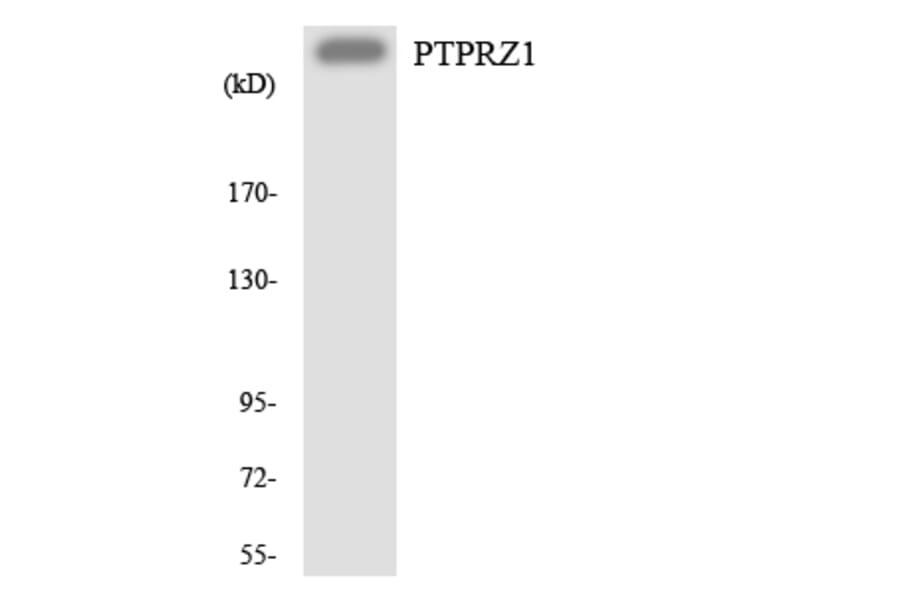 Western Blot - Anti-PTPRZ1 Antibody (R12-3383) - Antibodies.com