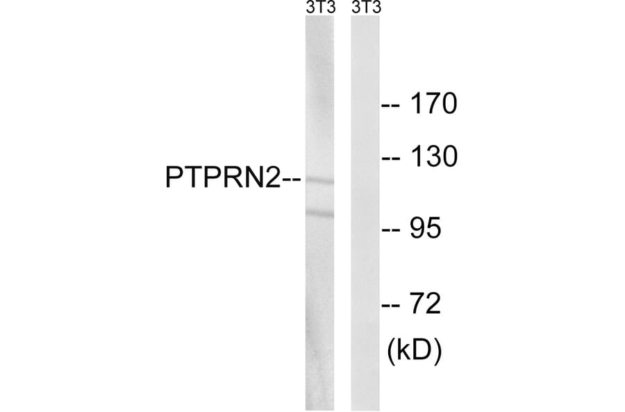 Western Blot - Anti-PTPRN2 Antibody (C18297) - Antibodies.com