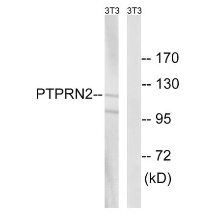 Western Blot - Anti-PTPRN2 Antibody (C18297) - Antibodies.com