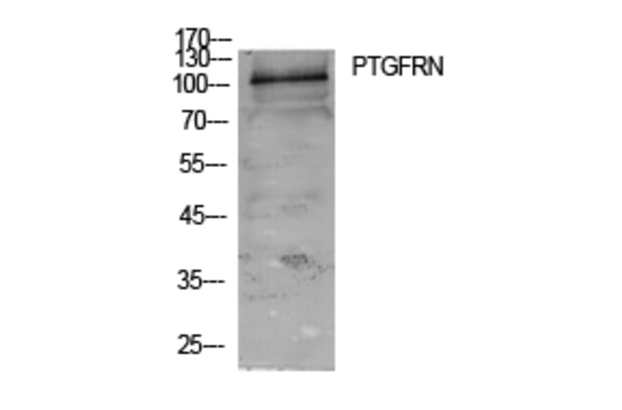 Western Blot - Anti-PTGFRN Antibody (C30561) - Antibodies.com