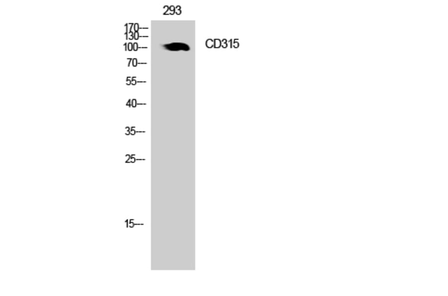 Western Blot - Anti-PTGFRN Antibody (C30561) - Antibodies.com