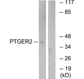 Western Blot - Anti-PTGER2 Antibody (G720) - Antibodies.com