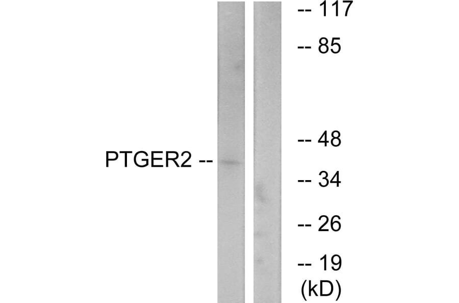 Western Blot - Anti-PTGER2 Antibody (G720) - Antibodies.com