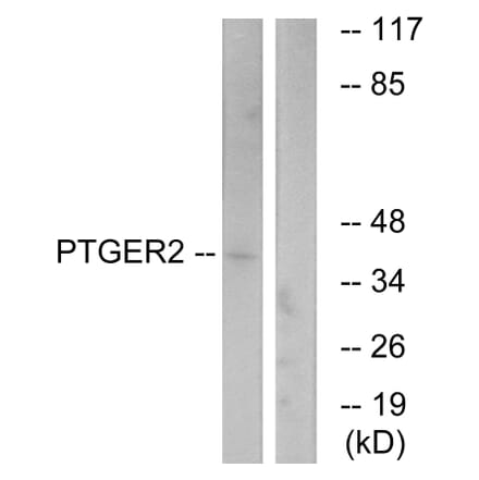 Western Blot - Anti-PTGER2 Antibody (G720) - Antibodies.com