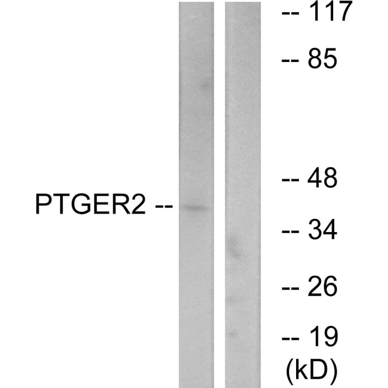 Western Blot - Anti-PTGER2 Antibody (G720) - Antibodies.com