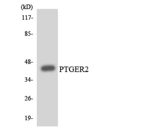Western Blot - Anti-PTGER2 Antibody (R12-3381) - Antibodies.com
