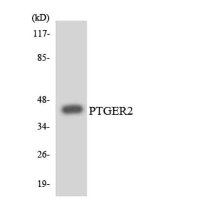 Western Blot - Anti-PTGER2 Antibody (R12-3381) - Antibodies.com