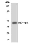 Western Blot - Anti-PTGER2 Antibody (R12-3381) - Antibodies.com
