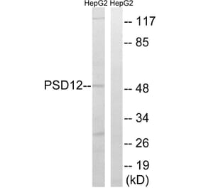 Western Blot - Anti-PSMD12 Antibody (C14021) - Antibodies.com