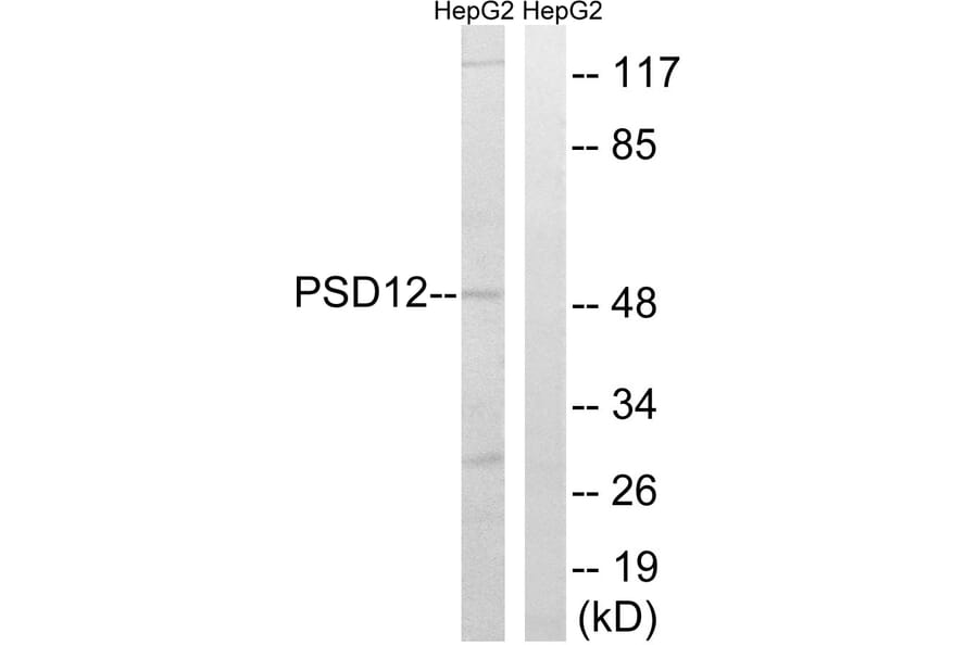 Western Blot - Anti-PSMD12 Antibody (C14021) - Antibodies.com