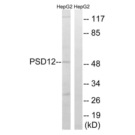 Western Blot - Anti-PSMD12 Antibody (C14021) - Antibodies.com