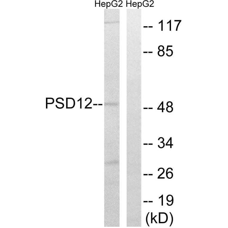 Western Blot - Anti-PSMD12 Antibody (C14021) - Antibodies.com