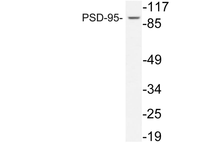 Western Blot - Anti-PSD-95 Antibody (R12-2324) - Antibodies.com