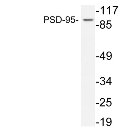 Western Blot - Anti-PSD-95 Antibody (R12-2324) - Antibodies.com