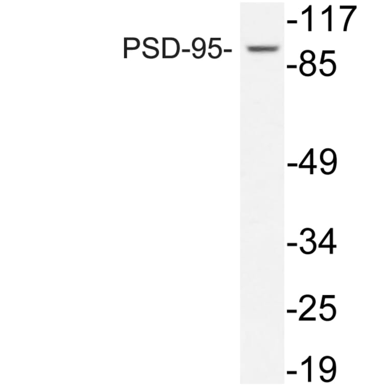 Western Blot - Anti-PSD-95 Antibody (R12-2324) - Antibodies.com