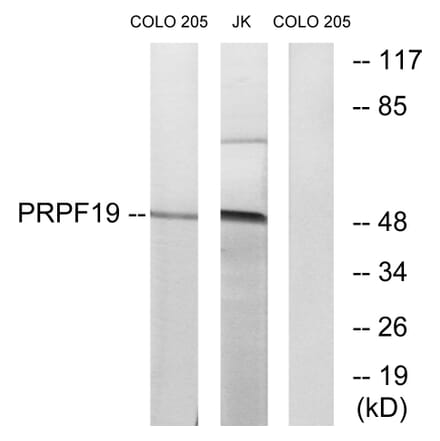 Western Blot - Anti-PRPF19 Antibody (C13105) - Antibodies.com