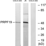 Western Blot - Anti-PRPF19 Antibody (C13105) - Antibodies.com