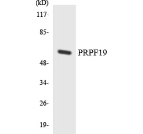 Western Blot - Anti-PRPF19 Antibody (R12-3371) - Antibodies.com
