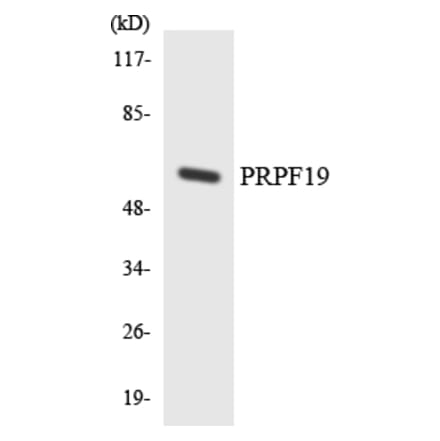 Western Blot - Anti-PRPF19 Antibody (R12-3371) - Antibodies.com