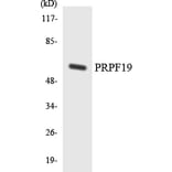 Western Blot - Anti-PRPF19 Antibody (R12-3371) - Antibodies.com