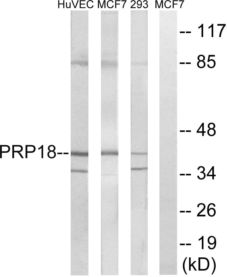 Western blot analysis of lysates from 293, MCF-7, and HUVEC cells using Anti-PRPF18 Antibody. The right hand lane represents a negative control, where the antibody is blocked by the immunising peptide.