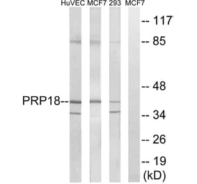 Western Blot - Anti-PRPF18 Antibody (C17852) - Antibodies.com