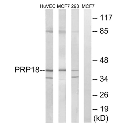 Western Blot - Anti-PRPF18 Antibody (C17852) - Antibodies.com