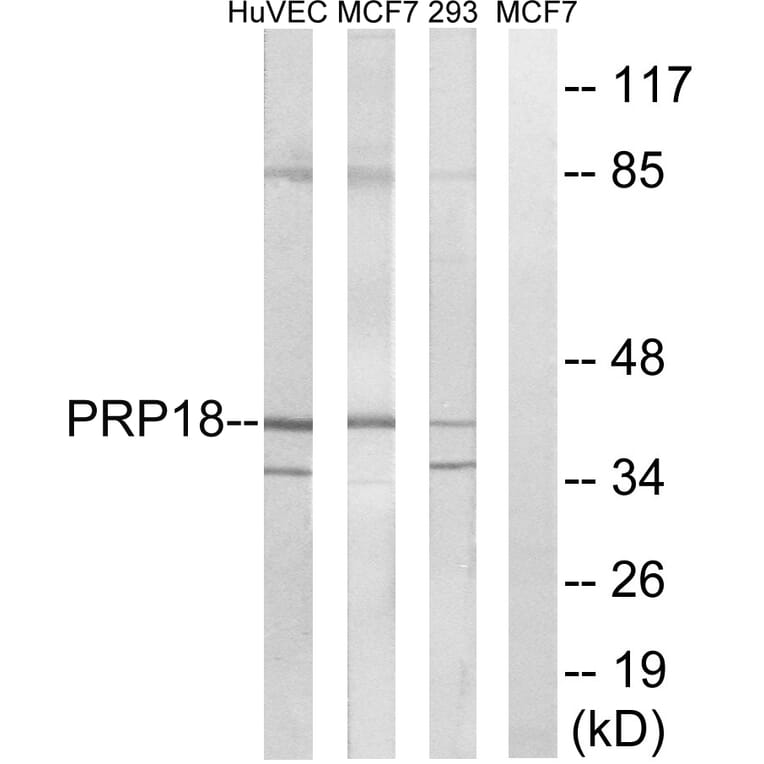 Western Blot - Anti-PRPF18 Antibody (C17852) - Antibodies.com