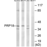 Western Blot - Anti-PRPF18 Antibody (C17852) - Antibodies.com