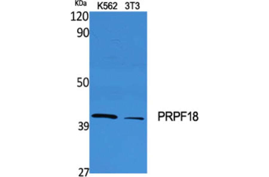 Western Blot - Anti-PRPF18 Antibody (C17852) - Antibodies.com