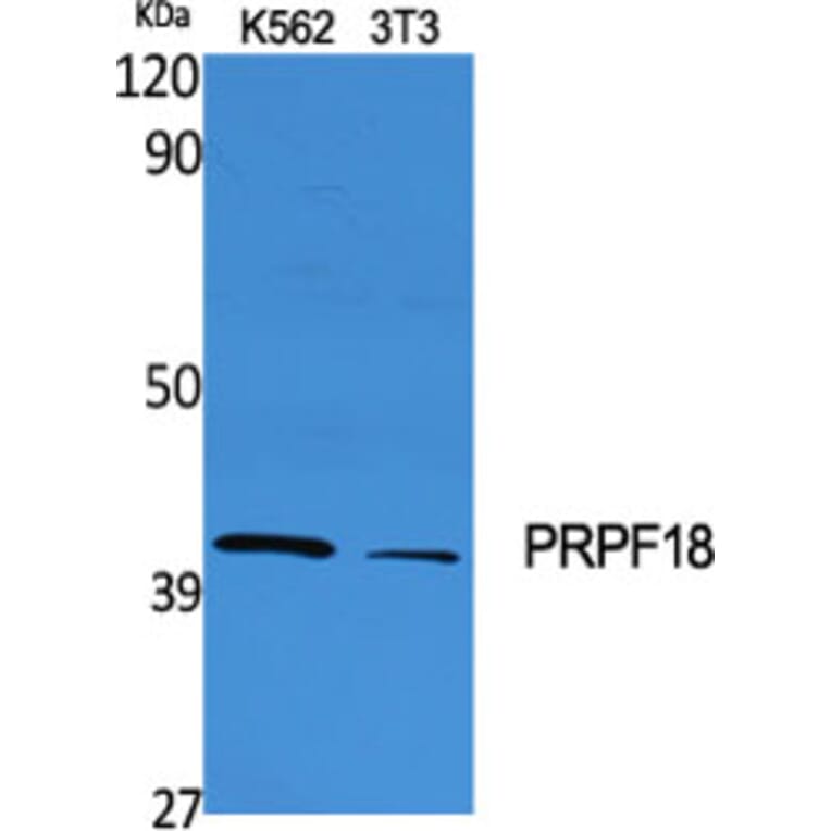 Western Blot - Anti-PRPF18 Antibody (C17852) - Antibodies.com