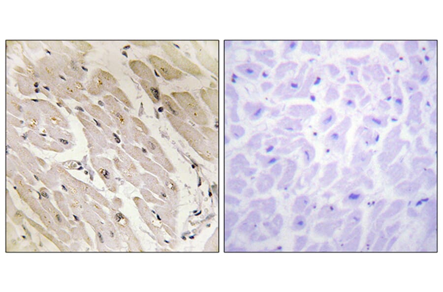 Immunohistochemistry - Anti-PRKAG2 Antibody (C11833) - Antibodies.com
