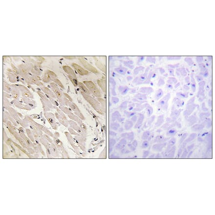 Immunohistochemistry - Anti-PRKAG2 Antibody (C11833) - Antibodies.com