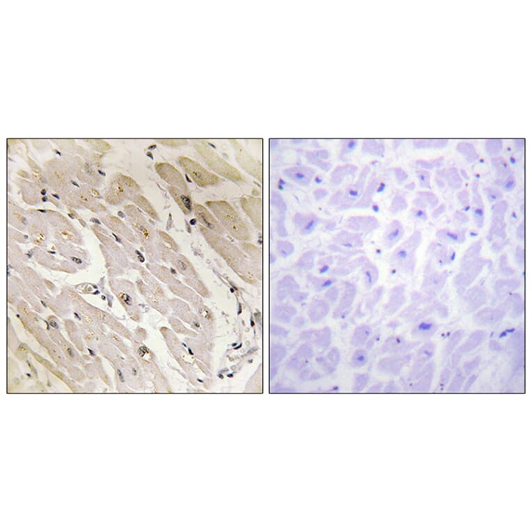 Immunohistochemistry - Anti-PRKAG2 Antibody (C11833) - Antibodies.com