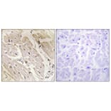 Immunohistochemistry - Anti-PRKAG2 Antibody (C11833) - Antibodies.com
