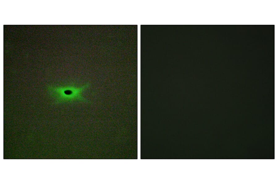 Immunofluorescence - Anti-PRKAG2 Antibody (C11833) - Antibodies.com