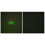 Immunofluorescence - Anti-PRKAG2 Antibody (C11833) - Antibodies.com