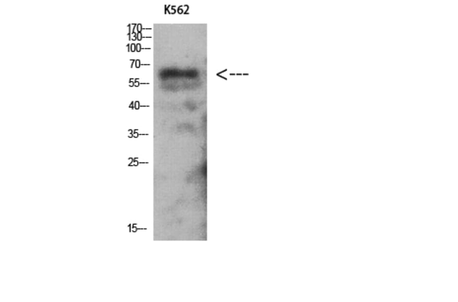 Western Blot - Anti-PRKAG2 Antibody (C11833) - Antibodies.com