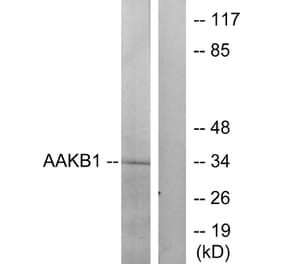 Western Blot - Anti-PRKAB1 Antibody (C12821) - Antibodies.com