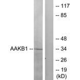 Western Blot - Anti-PRKAB1 Antibody (C12821) - Antibodies.com