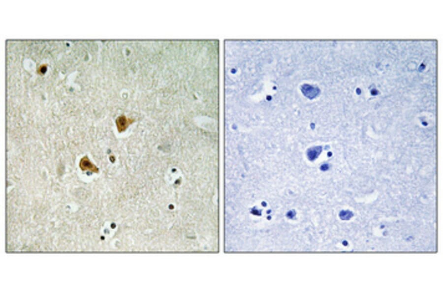 Immunohistochemistry - Anti-PRKAB1 Antibody (C12821) - Antibodies.com
