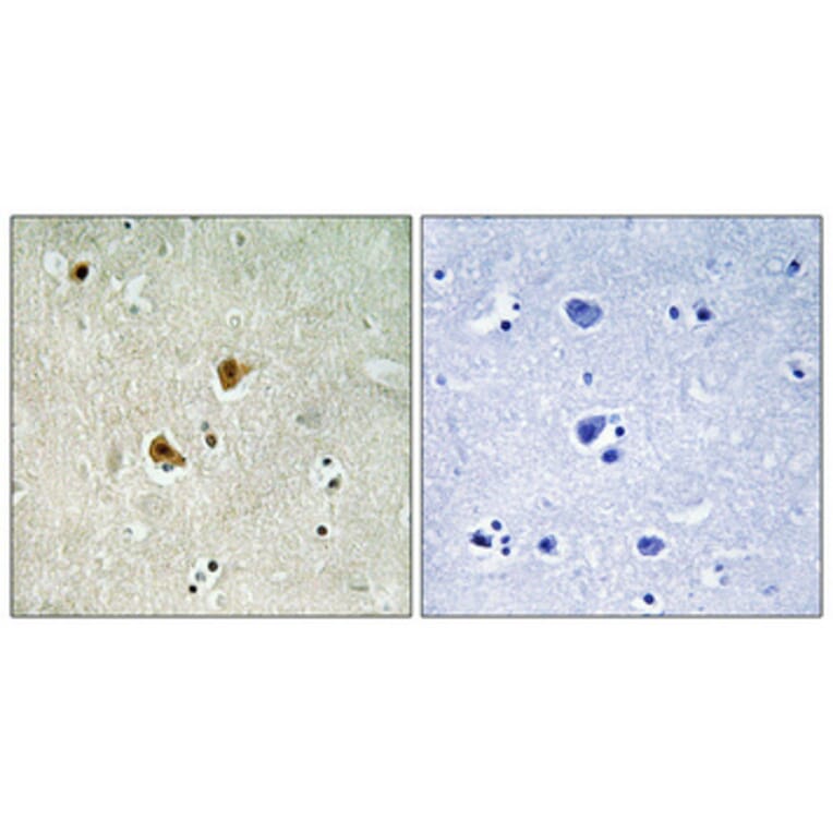 Immunohistochemistry - Anti-PRKAB1 Antibody (C12821) - Antibodies.com