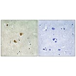 Immunohistochemistry - Anti-PRKAB1 Antibody (C12821) - Antibodies.com