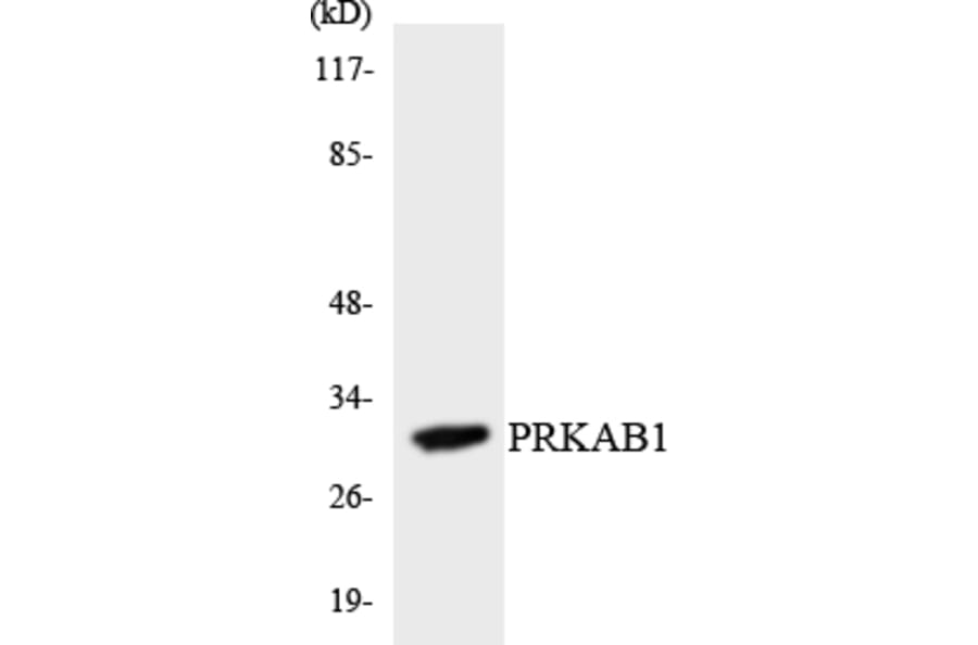 Western Blot - Anti-PRKAB1 Antibody (R12-3362) - Antibodies.com