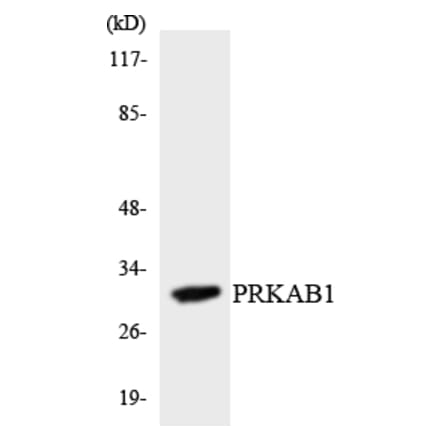 Western Blot - Anti-PRKAB1 Antibody (R12-3362) - Antibodies.com